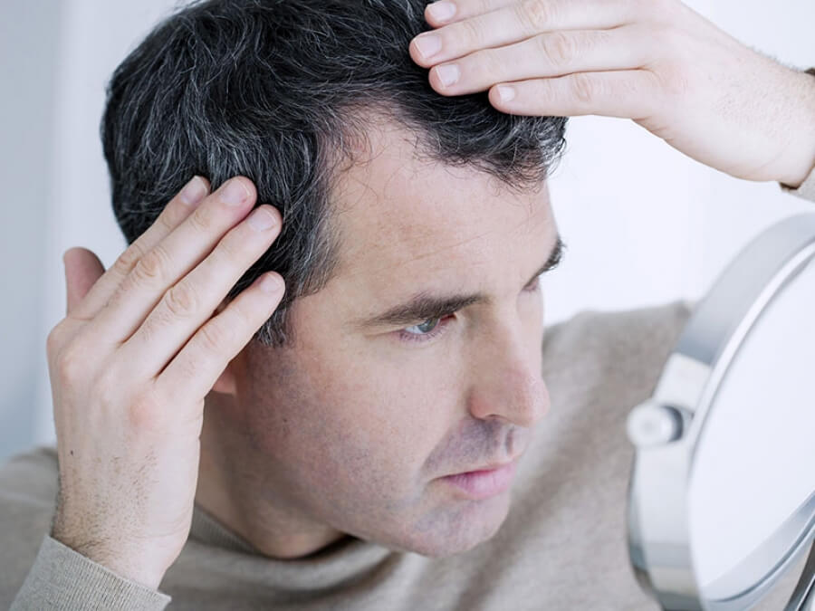 the main image - genetics hair loss relation