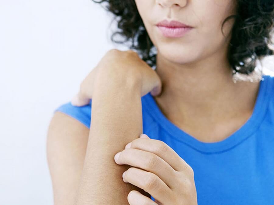 the main image - causes itchy skin