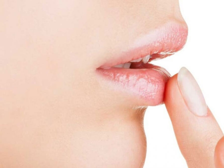 the main image - causes of chapped lips
