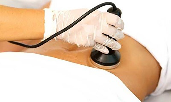 the main image - cavitation laser