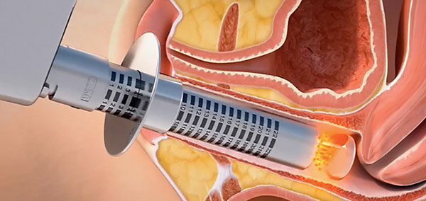 the main image - monalisa touch